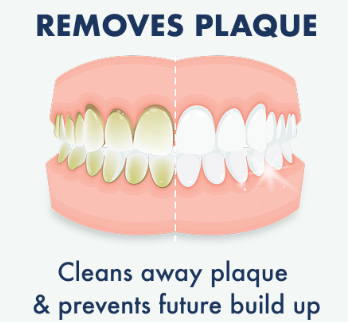 LIVFRESH DENTAL GEL TOOTHPASTE 1.75 OZ