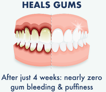 LIVFRESH DENTAL GEL TOOTHPASTE 1.75 OZ